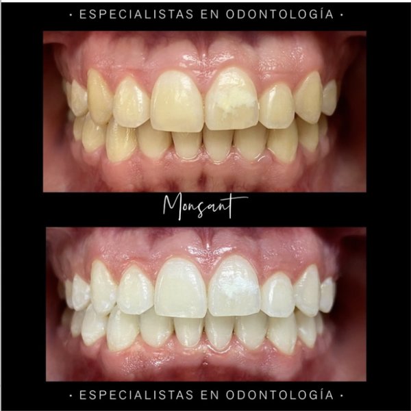 Resultado 1