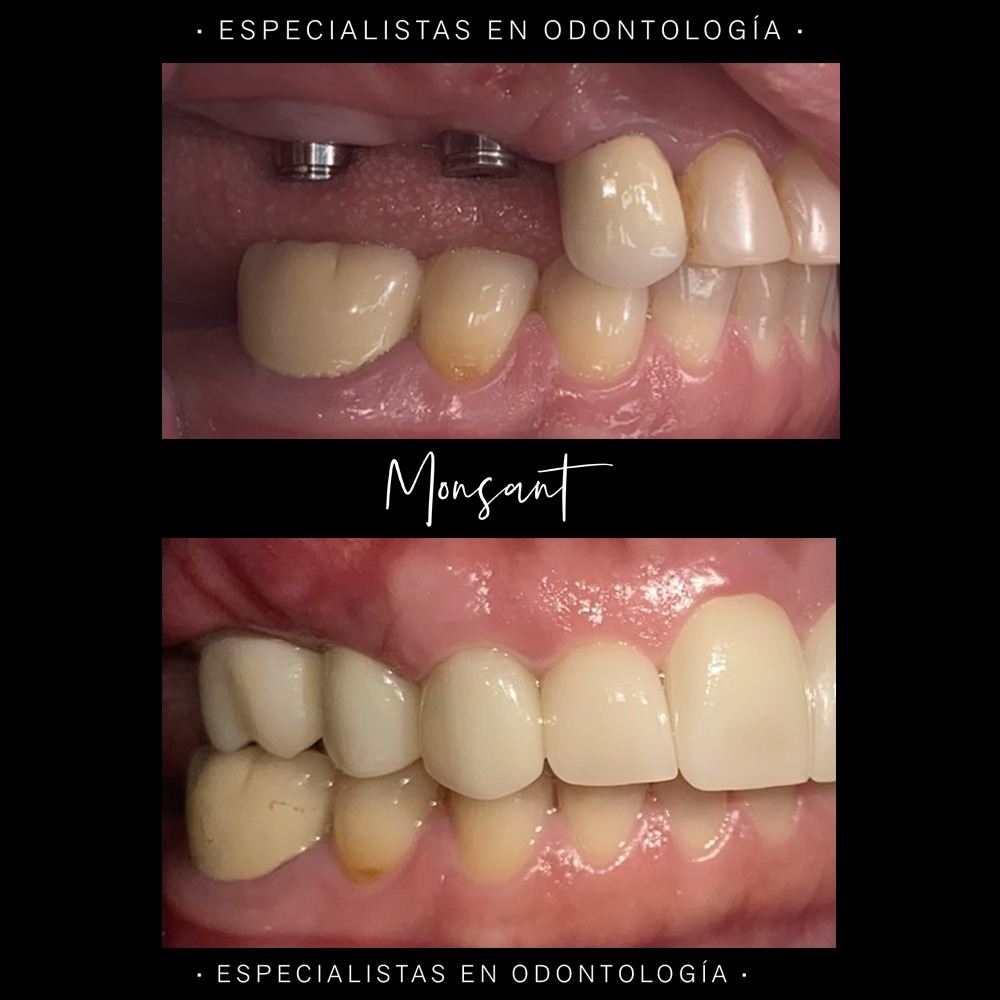 Resultado 3
